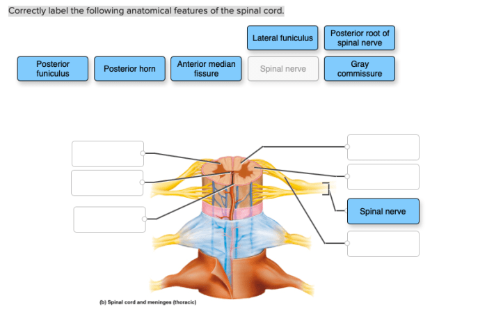 Correctly label the anatomical features of the otolithic membrane