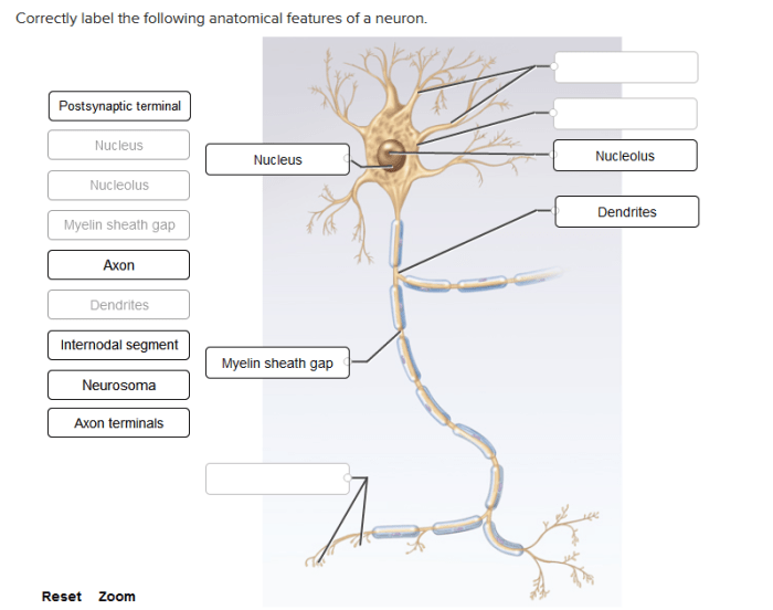 Correctly label the anatomical features of the otolithic membrane